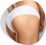Gluteoplastica