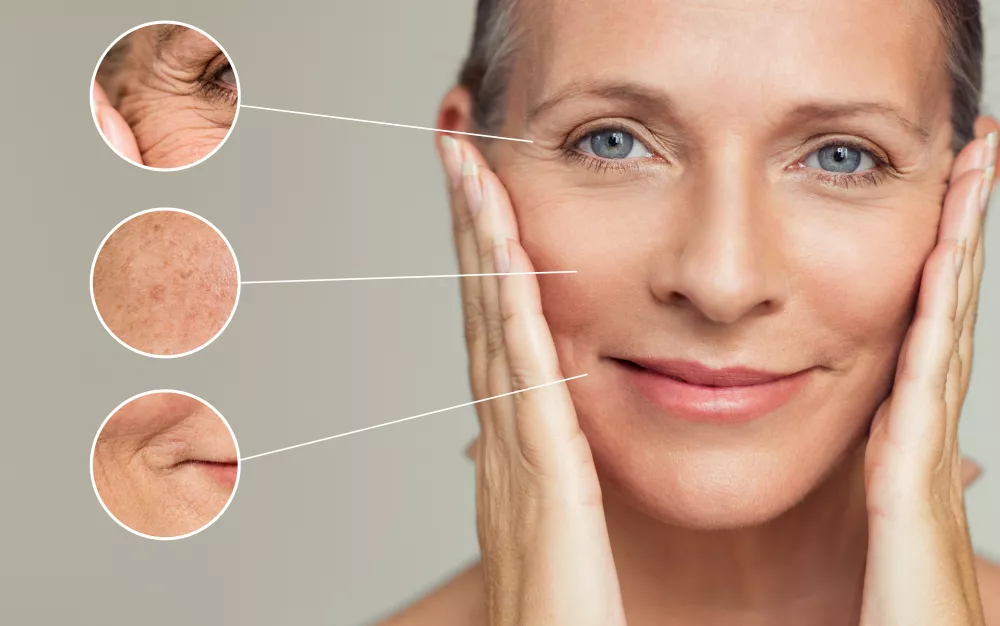 quanti anni dura l'effetto di un lifting al viso