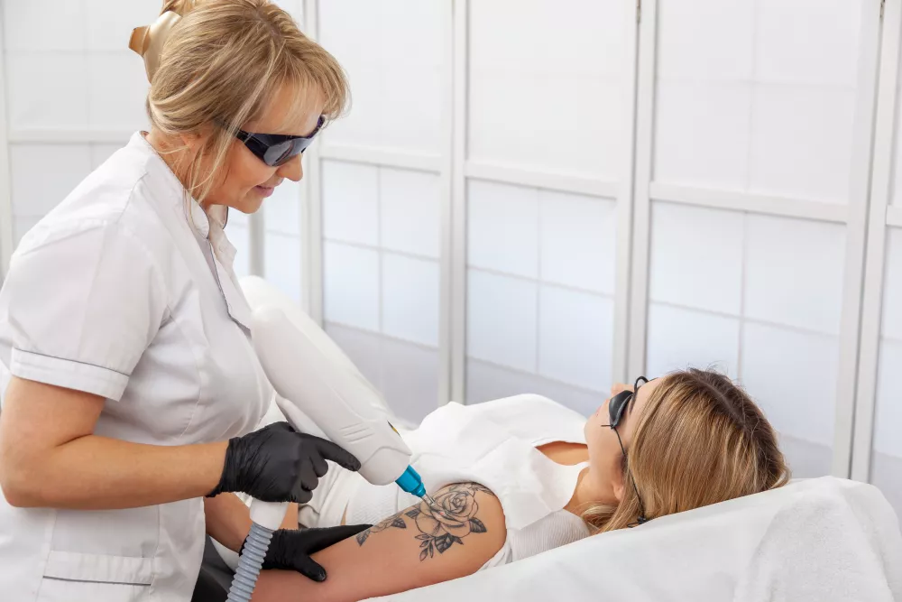 quanto costa la rimozione di un tatuaggio