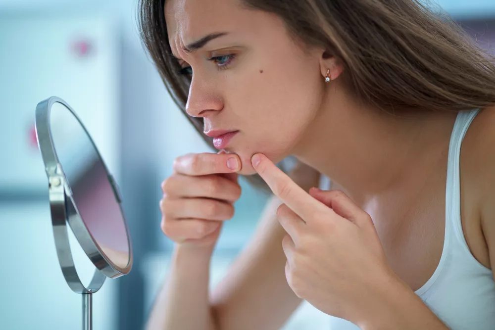 quanti tipi di acne ci sono