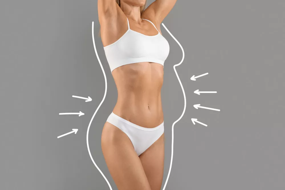 differenza tra liposcultura e liposuzione