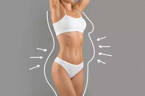 Che differenza c'è tra liposcultura e liposuzione?