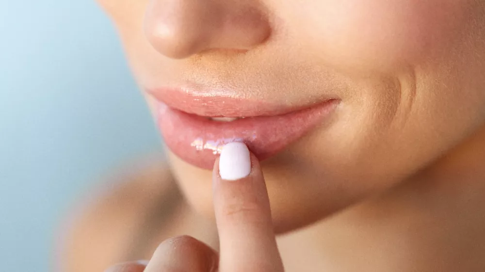 filler labbra